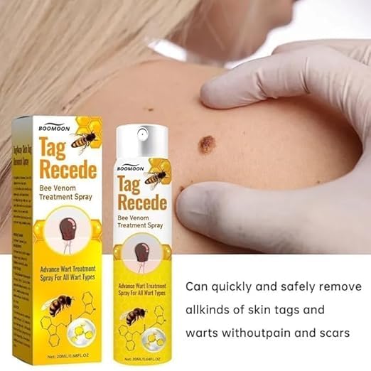 Wart & Skin Tag Removal Spray