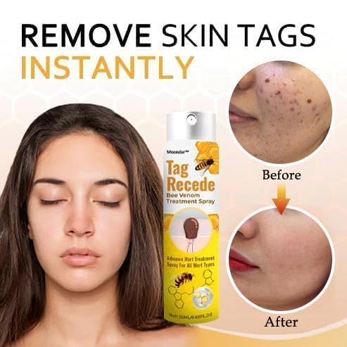 Wart & Skin Tag Removal Spray