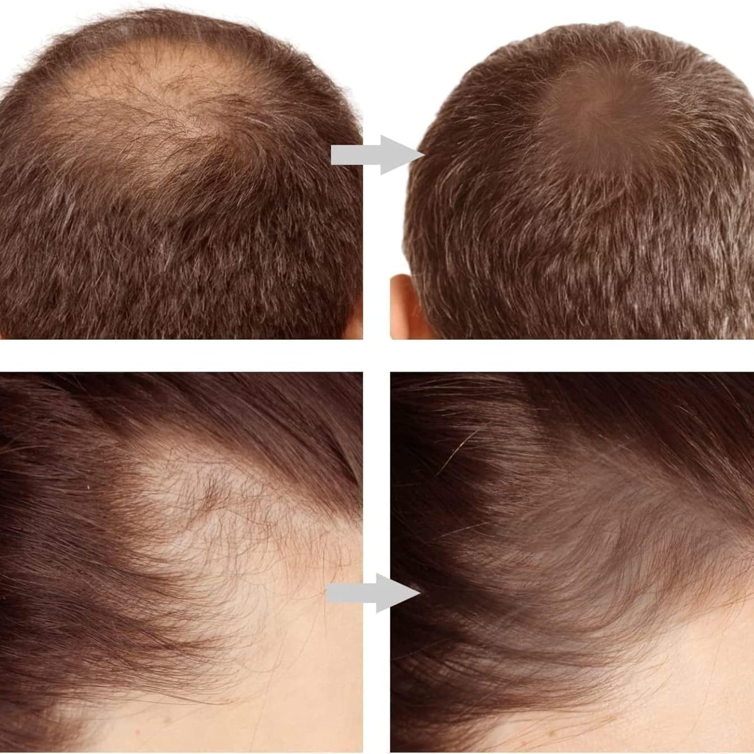 Hairline Powder Stick Black for Women & Men